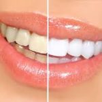 ADN Sample 4